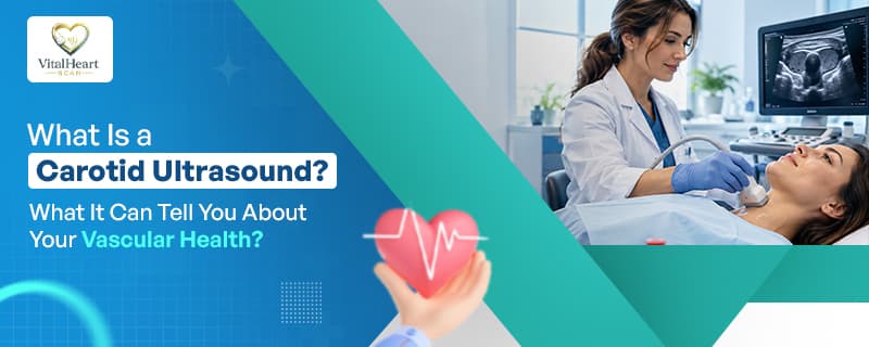 what is a carotid ultrasound