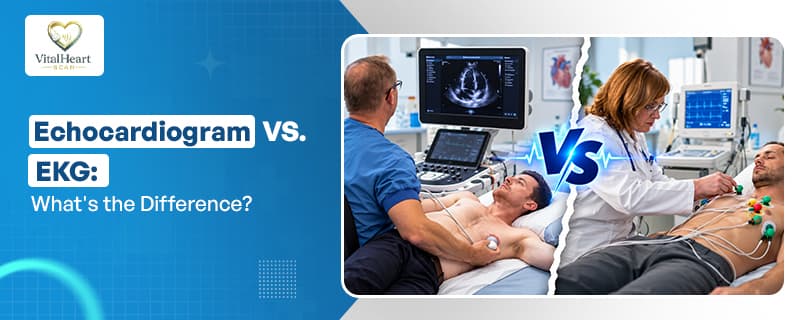 Echocardiogram vs. EKG
